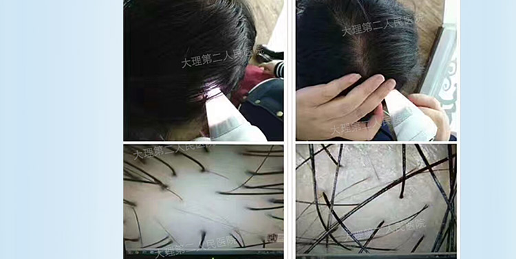 大头Z针_07.jpg