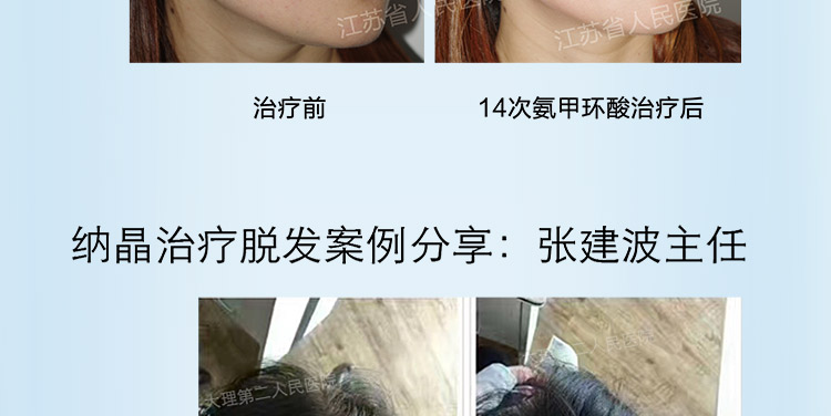 大头Z针_06.jpg