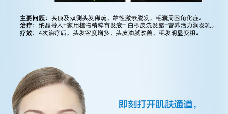 大头Z针_08.jpg