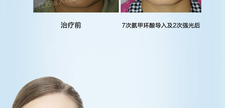 小头A针_08.jpg