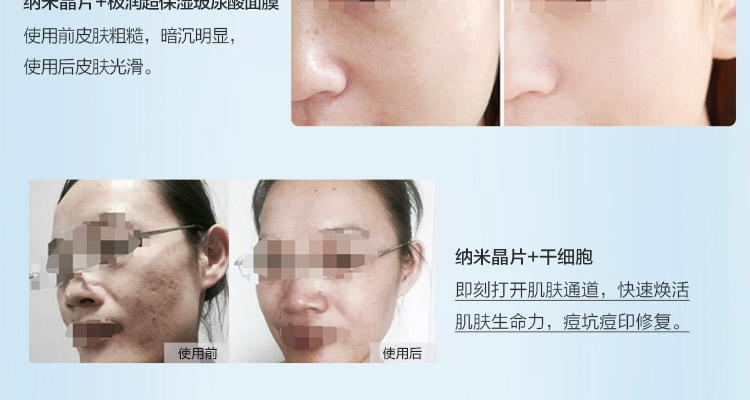 小头D针_06.jpg
