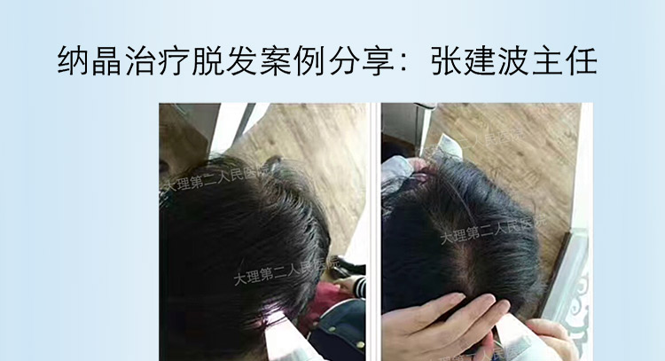 小头G针_06.jpg