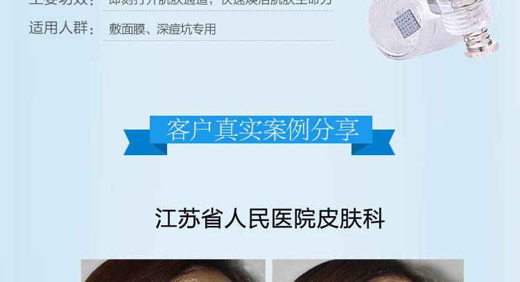 小头G针_04.jpg
