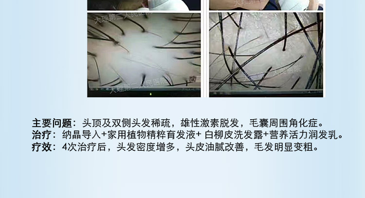 小头G针_07.jpg