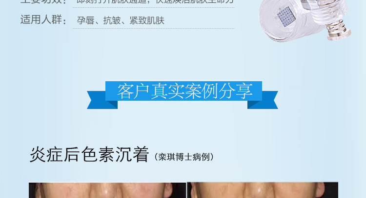 小头Z针_04.jpg
