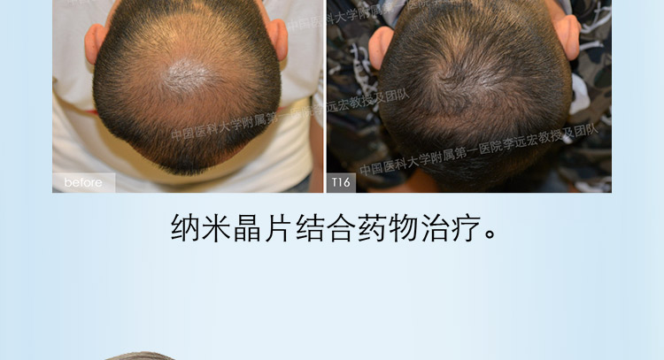 小头Z针_06.jpg