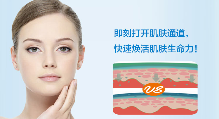 小头Z针_07.jpg