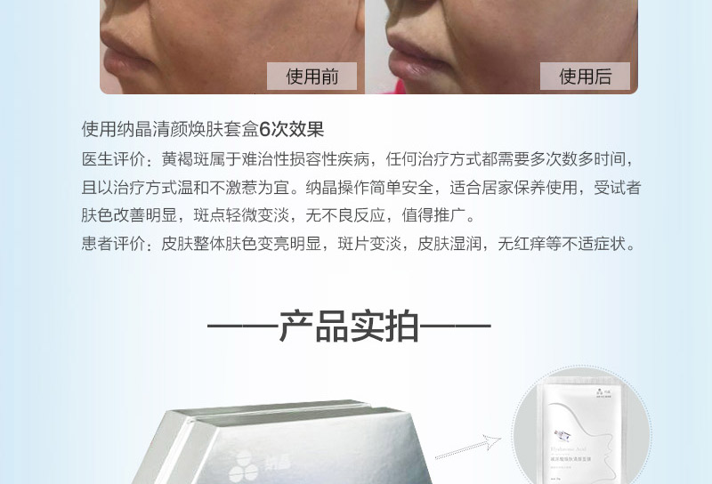 黄褐斑_09.jpg