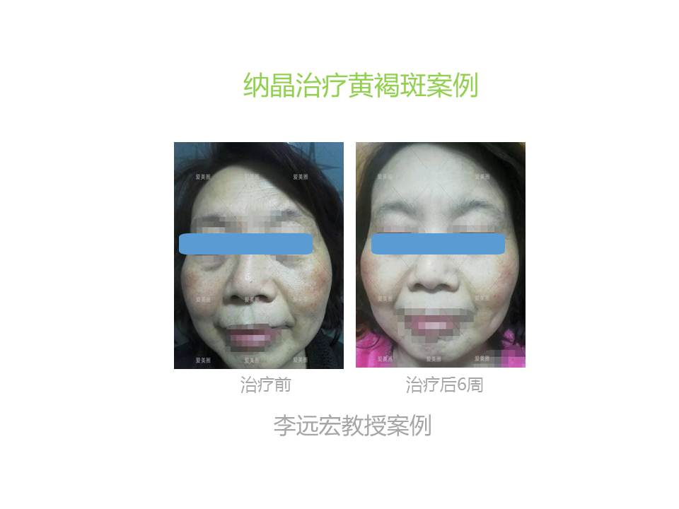 幻灯片6.JPG